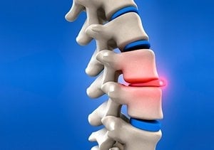NYC Chiropractic and Spinal Decompression Center picture